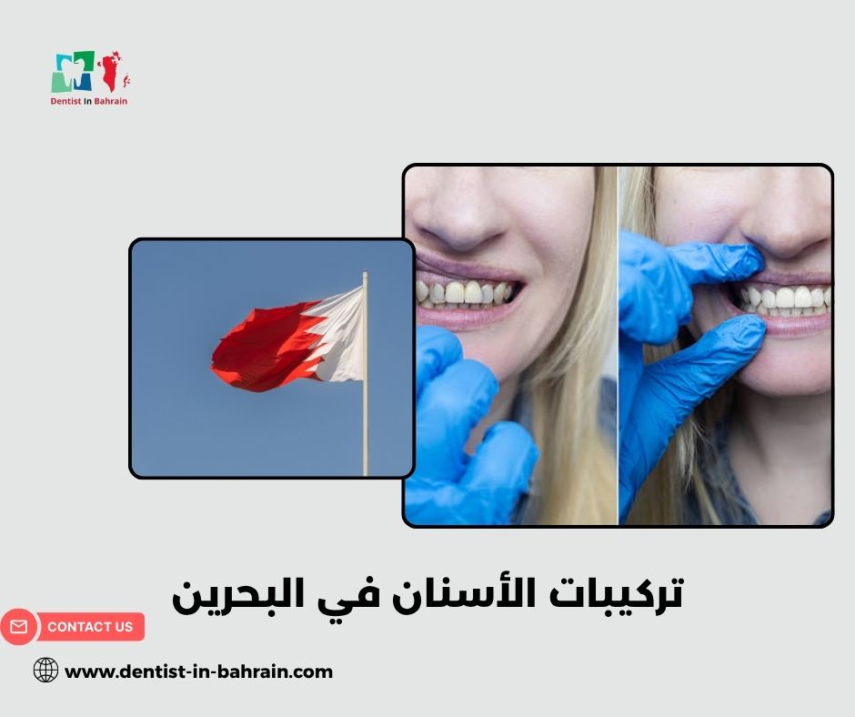 متى تحتاج إلى تركيبات الأسنان في مدينة حمد؟