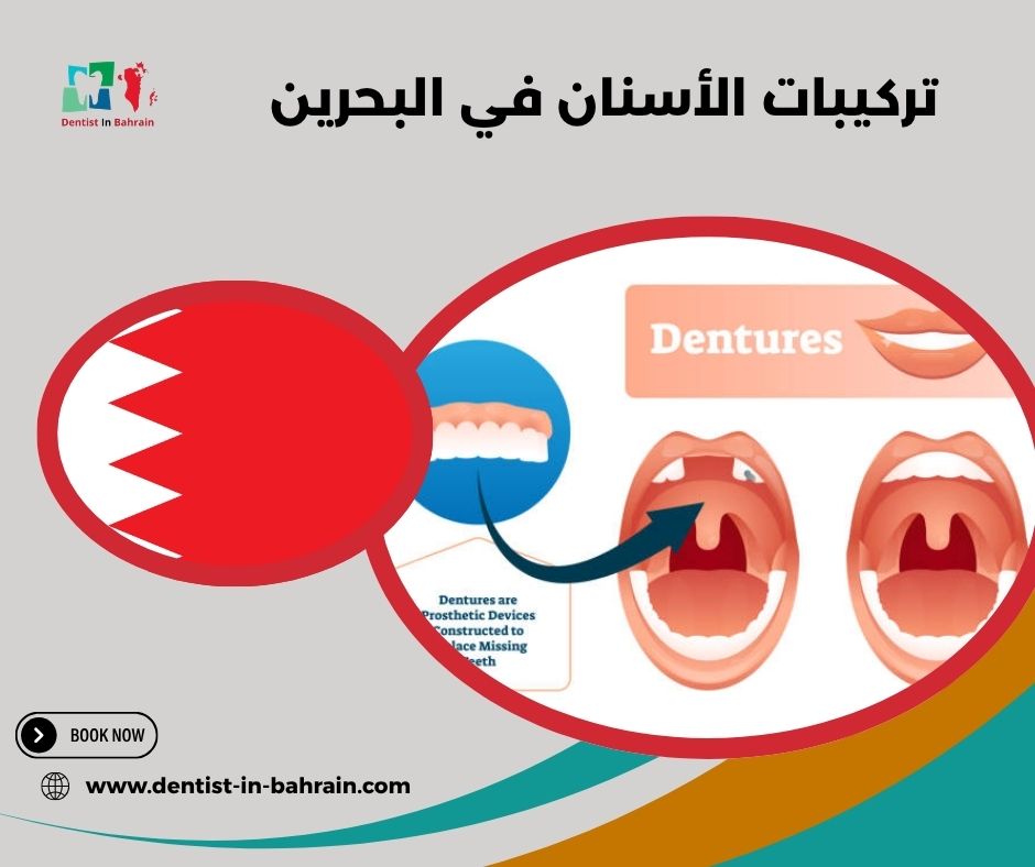 تكلفة تركيبات الأسنان في المنامة: دليل شامل