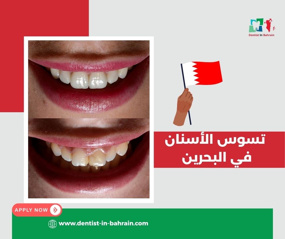 الوقاية من تسوس الأسنان في المحرق: نصائح يومية