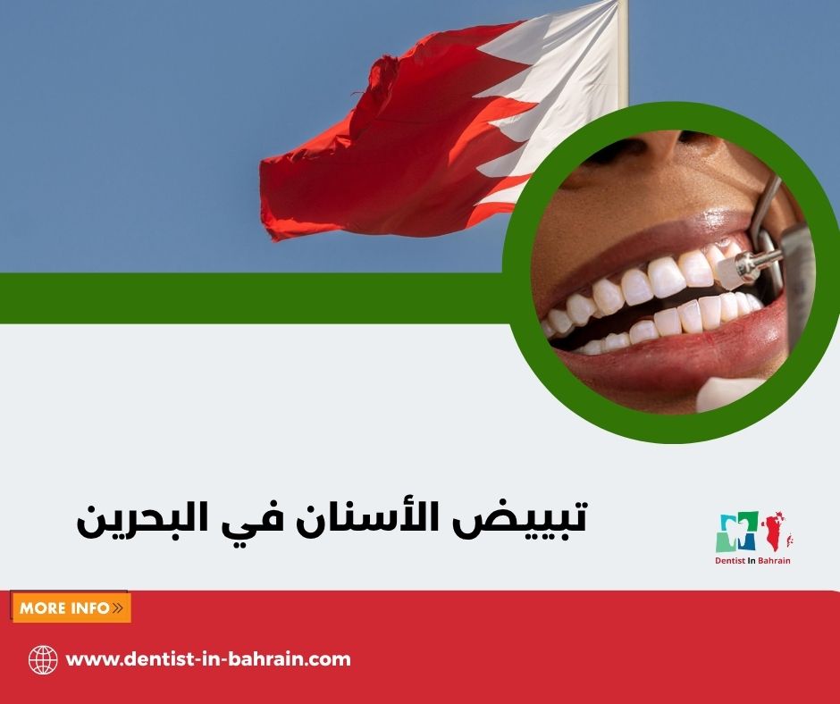 تكلفة تبييض الأسنان في البحرين: مقارنة الأسعار والنتائج في المحرق