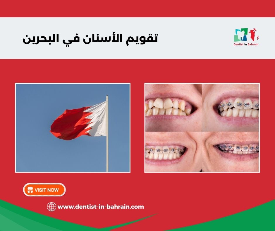 العناية بتقويم الأسنان في مدينة حمد: نصائح للحفاظ على نظافة الفم العناية بتقويم الأسنان في مدينة حمد: نصائح للحفاظ على نظافة الفم