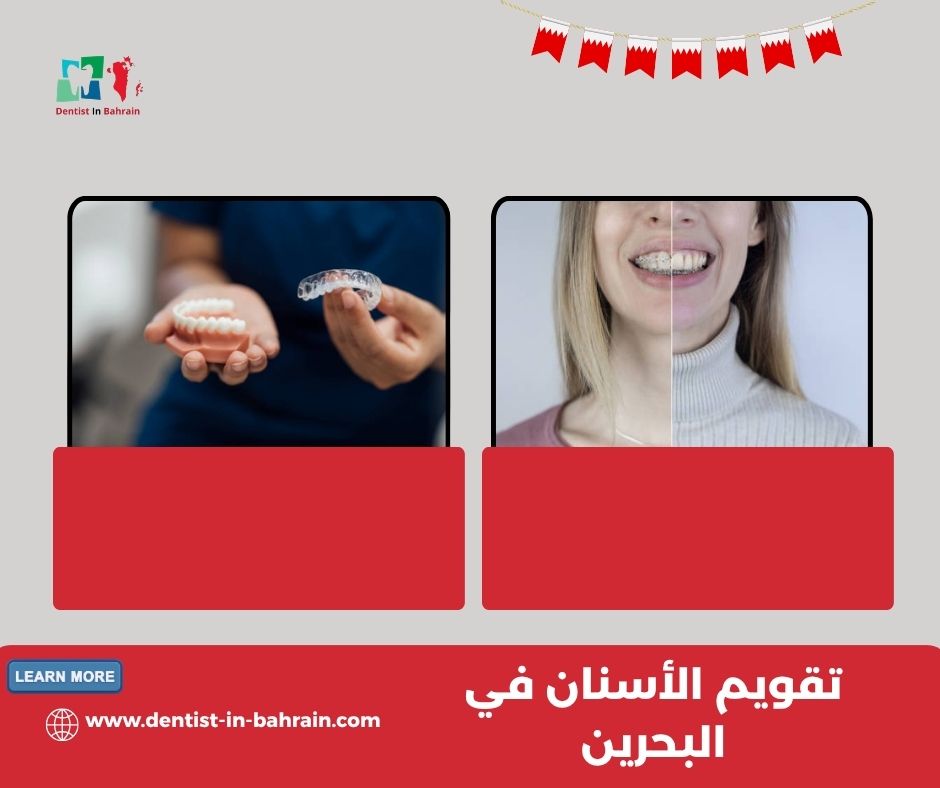 أنواع تقويم الأسنان في البحرين: المعدني، الشفاف، والداخلي أنواع تقويم الأسنان في البحرين: المعدني، الشفاف، والداخلي