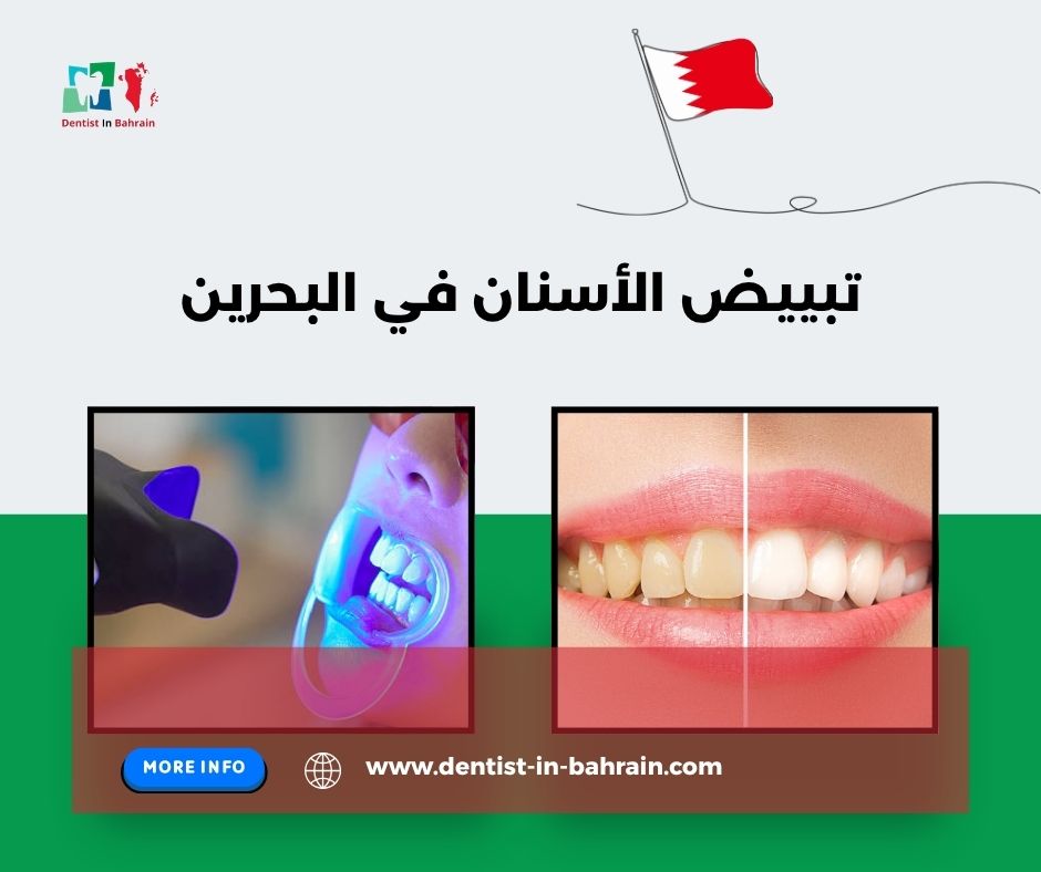 تبييض الأسنان في البحرين