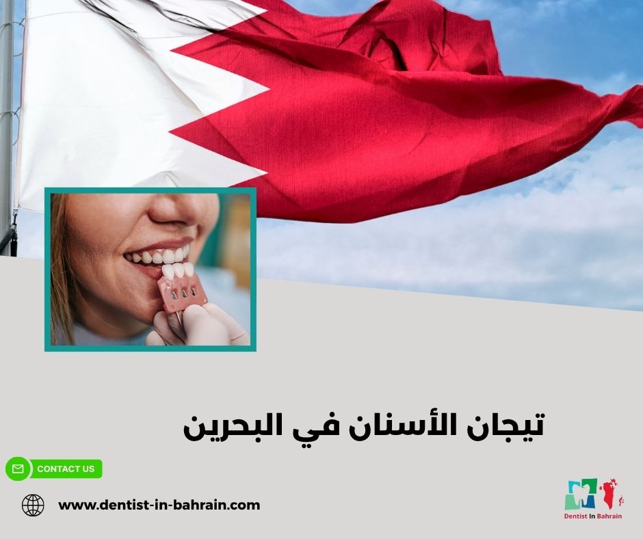 تيجان الأسنان الأمامية في مدينة حمد: استعادة جمال ابتسامتك