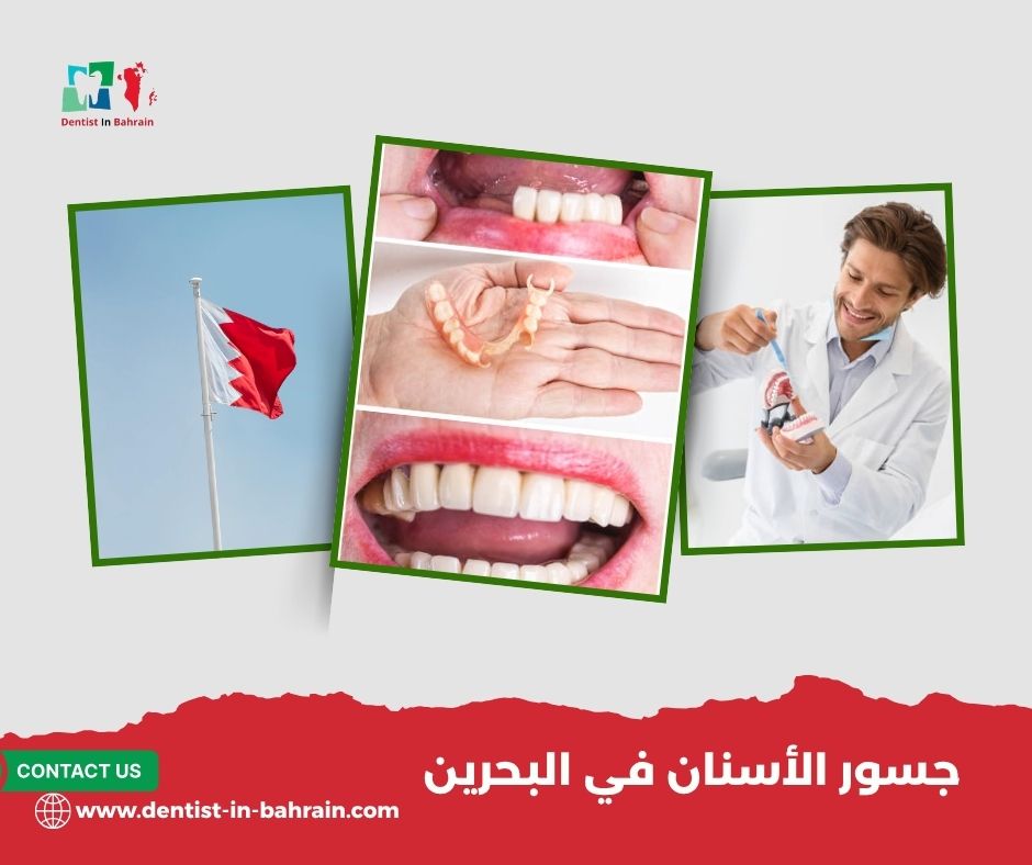 مزايا وعيوب جسور الأسنان في المحرق: هل هي الخيار المناسب لك؟