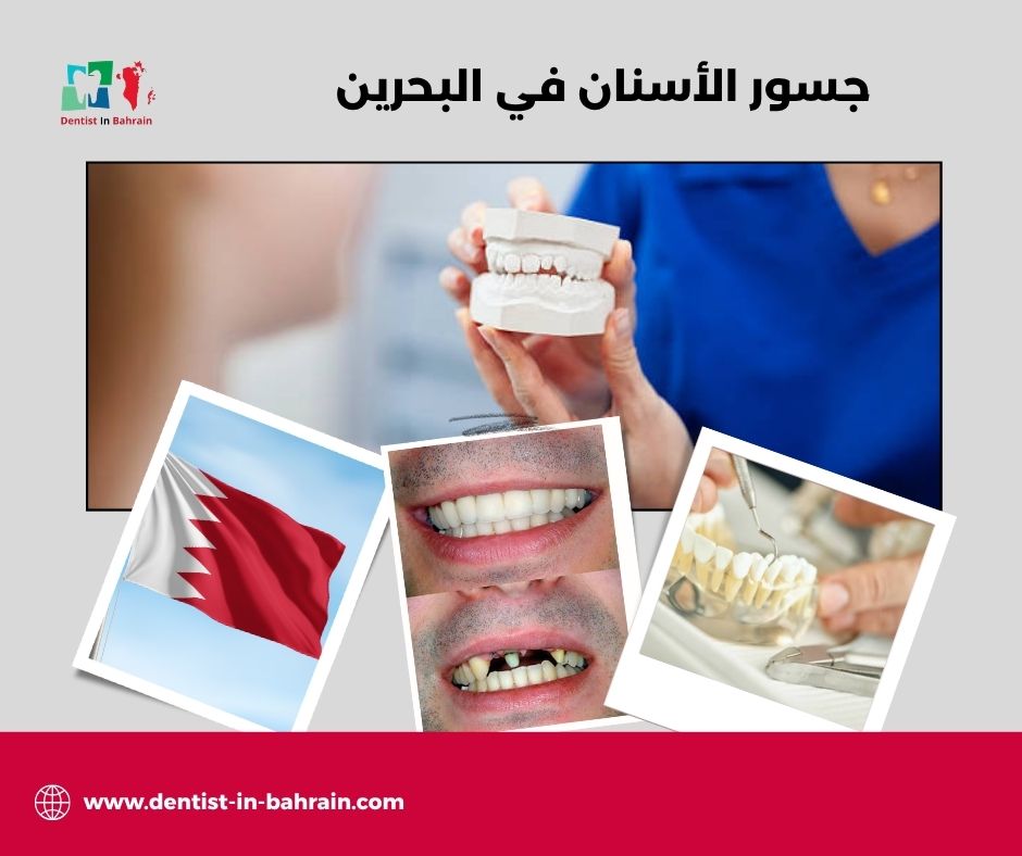 تكلفة جسور الأسنان في المنامة: مقارنة بين المواد