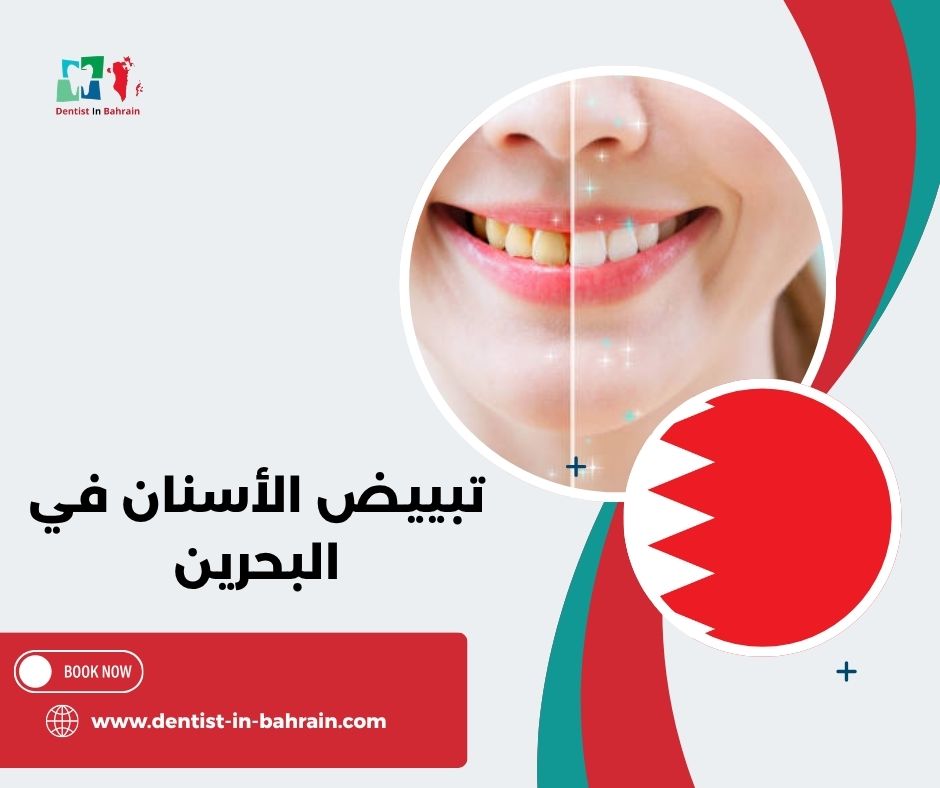 تبييض الأسنان في البحرين