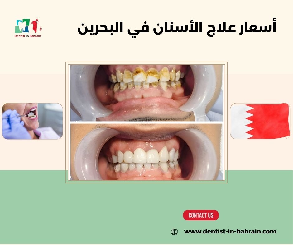 عوامل تؤثر على أسعار علاج الأسنان في المحرق: المواد، التقنيات، والعيادة