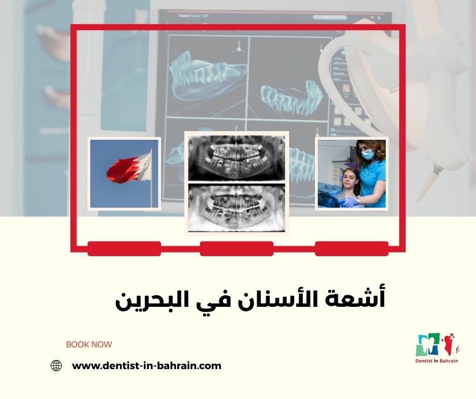 أشعة الأسنان في البحرين