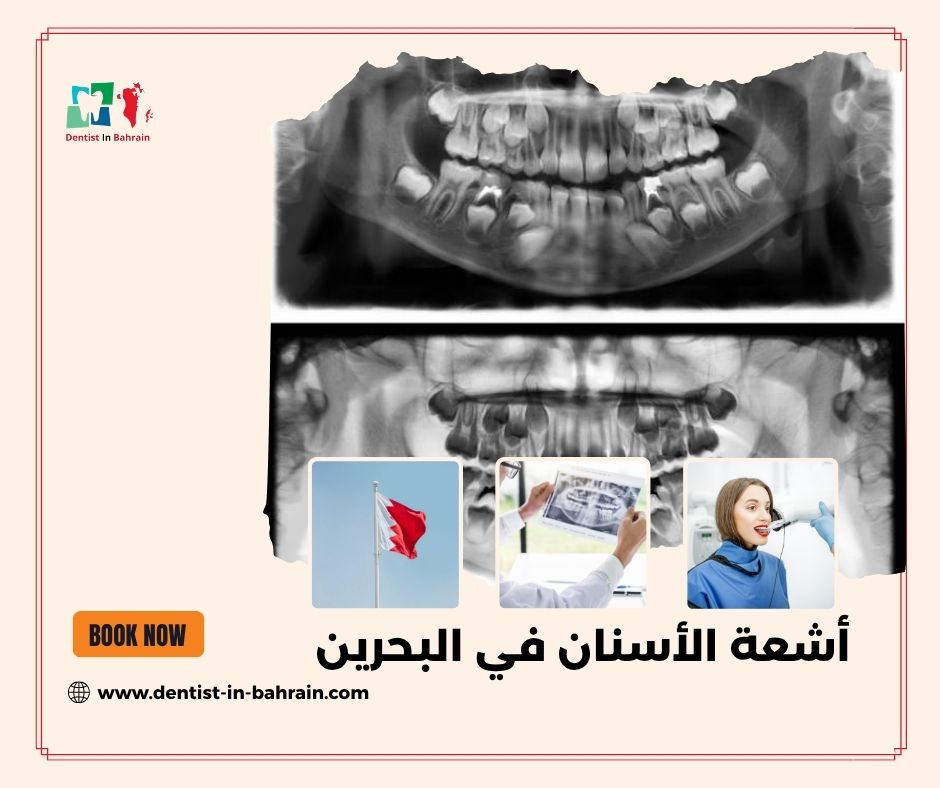 أشعة الأسنان في البحرين