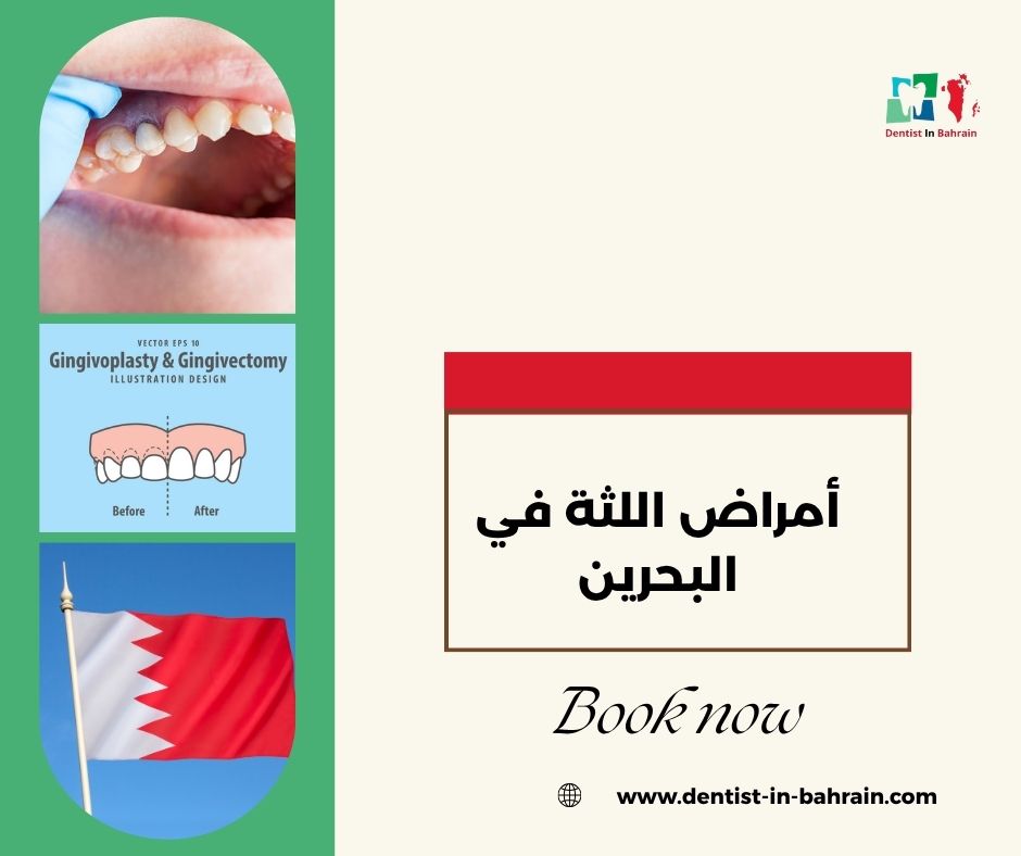 جراحة اللثة في مدينة عيسى: متى تكون ضرورية؟ جراحة اللثة في مدينة عيسى: متى تكون ضرورية؟