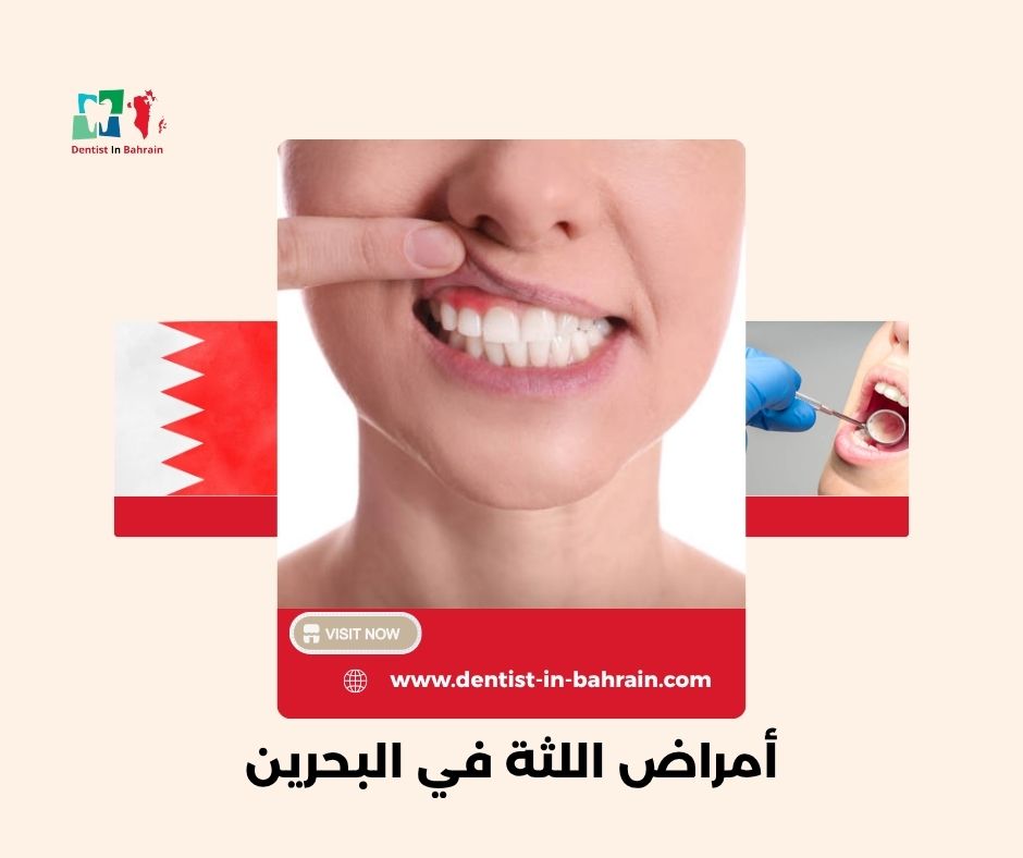 علاج أمراض اللثة في المنامة: الطرق الحديثة والفعالة. علاج أمراض اللثة في المنامة: الطرق الحديثة والفعالة.