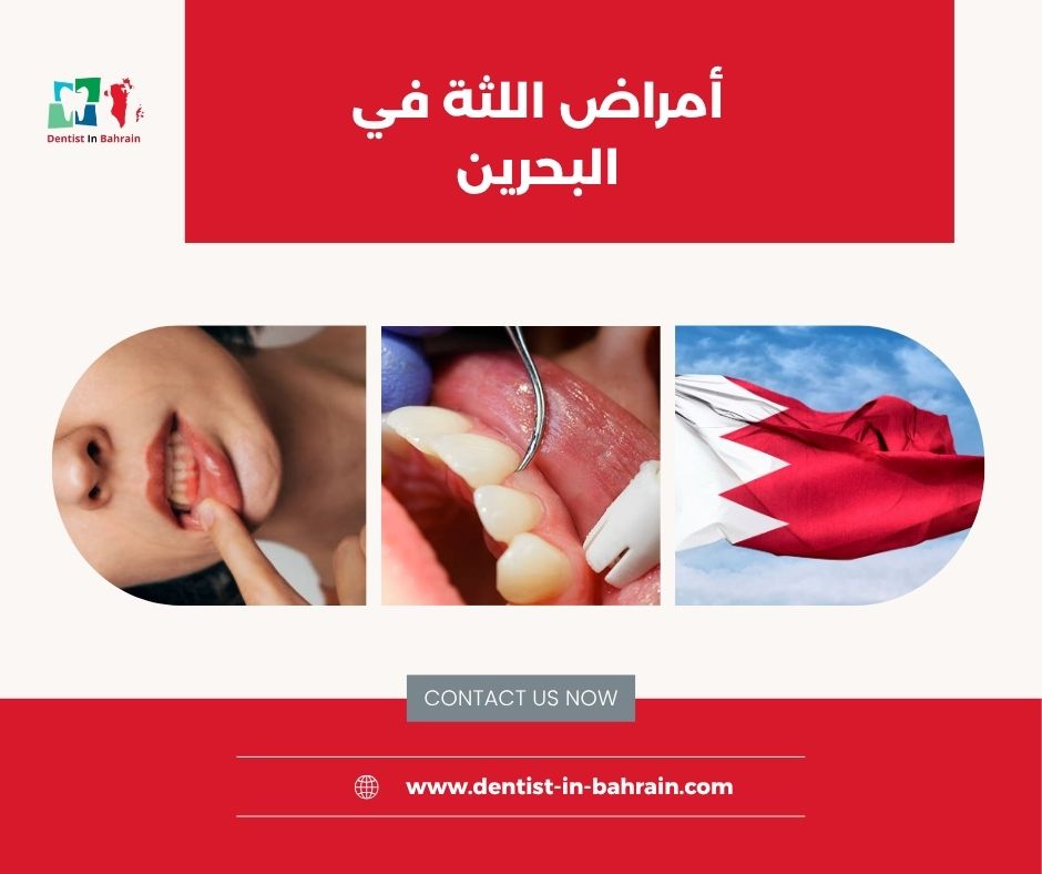 أعراض أمراض اللثة في البحرين: متى يجب القلق؟ أعراض أمراض اللثة في البحرين: متى يجب القلق؟