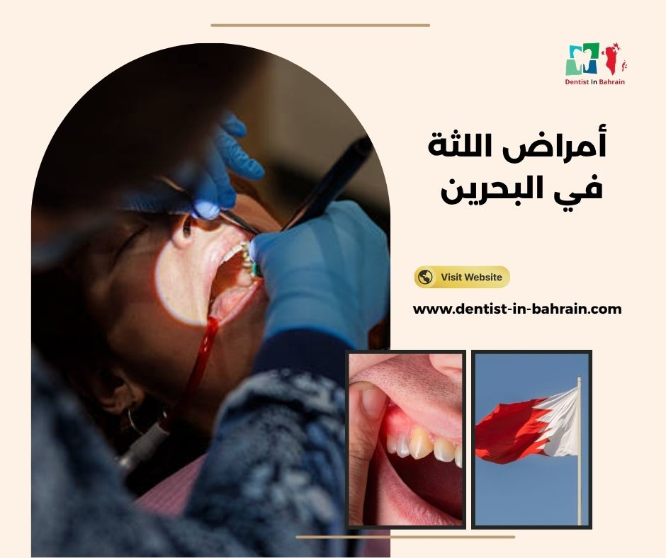 أمراض اللثة في البحرين أمراض اللثة في البحرين
