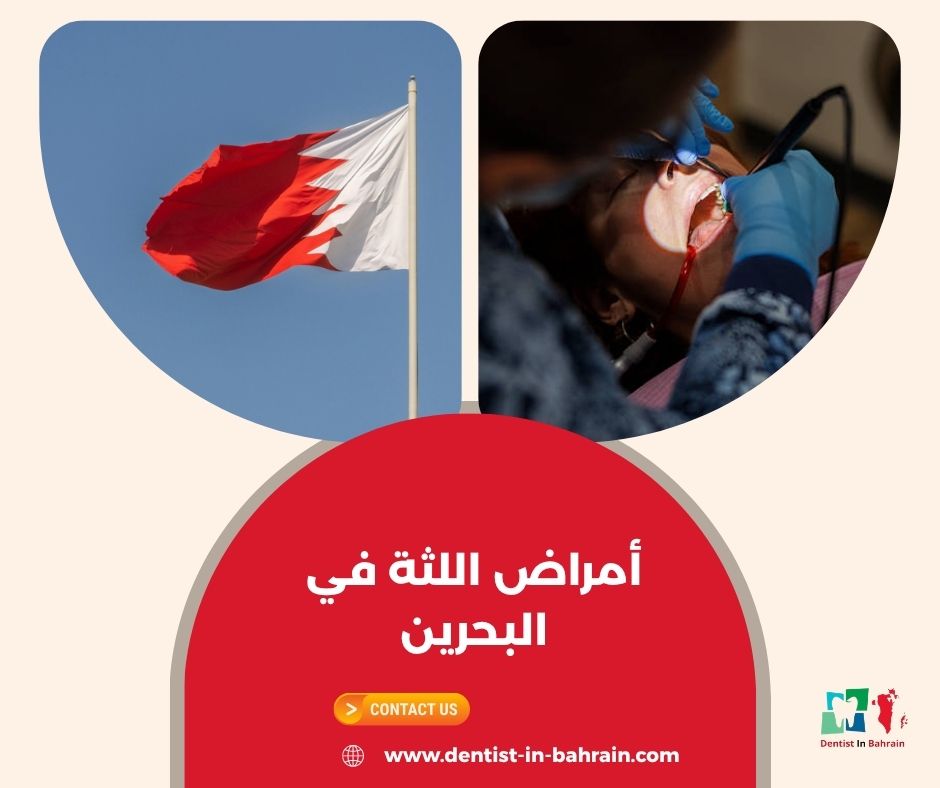 أمراض اللثة في البحرين أمراض اللثة في البحرين