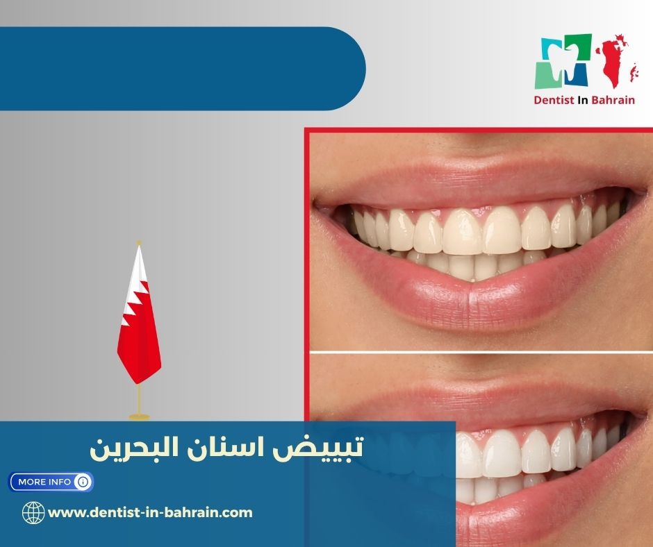 تبييض اسنان البحرين