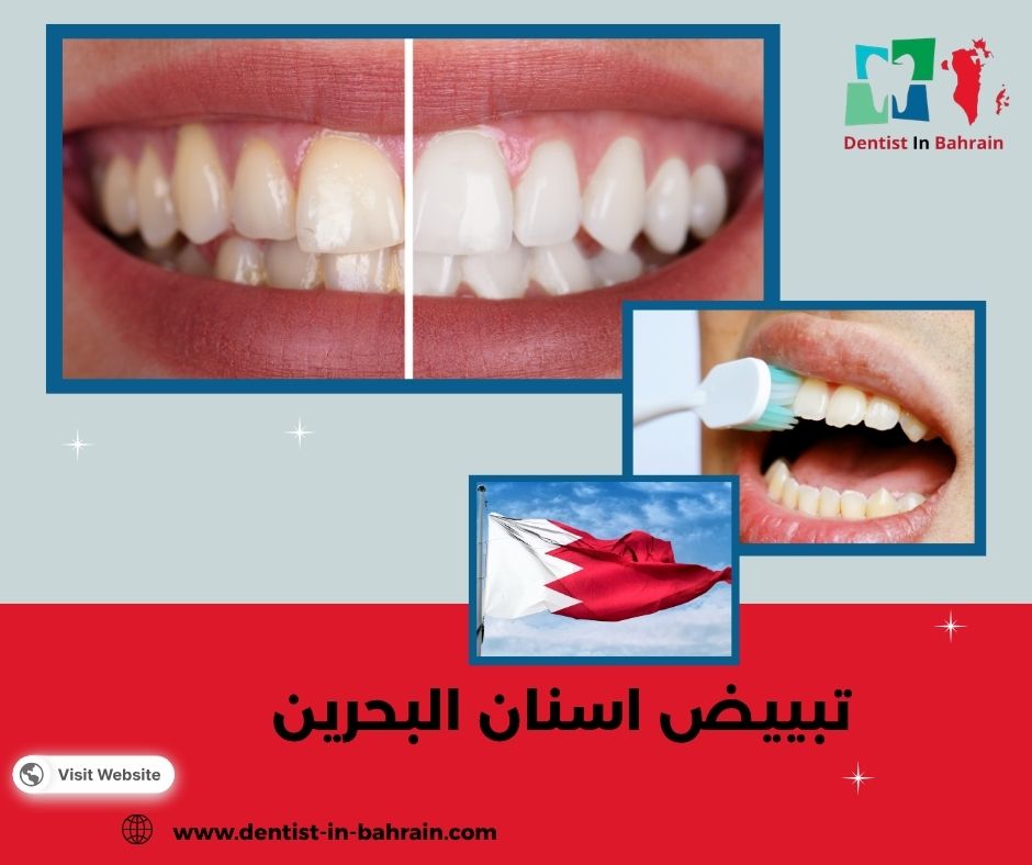 تبييض اسنان البحرين