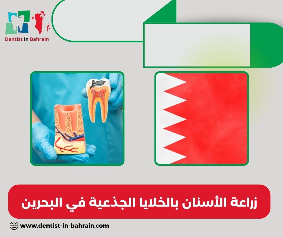 زراعة الأسنان بالخلايا الجذعية في البحرين