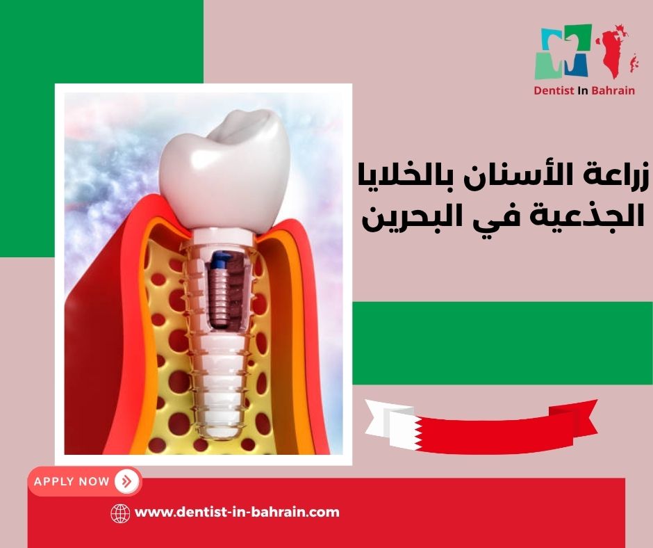 زراعة الأسنان بالخلايا الجذعية في البحرين