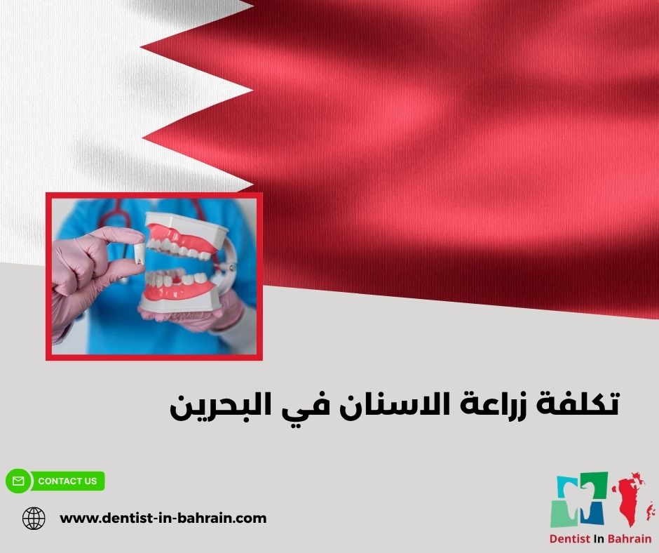 تكلفة زراعة الاسنان في البحرين