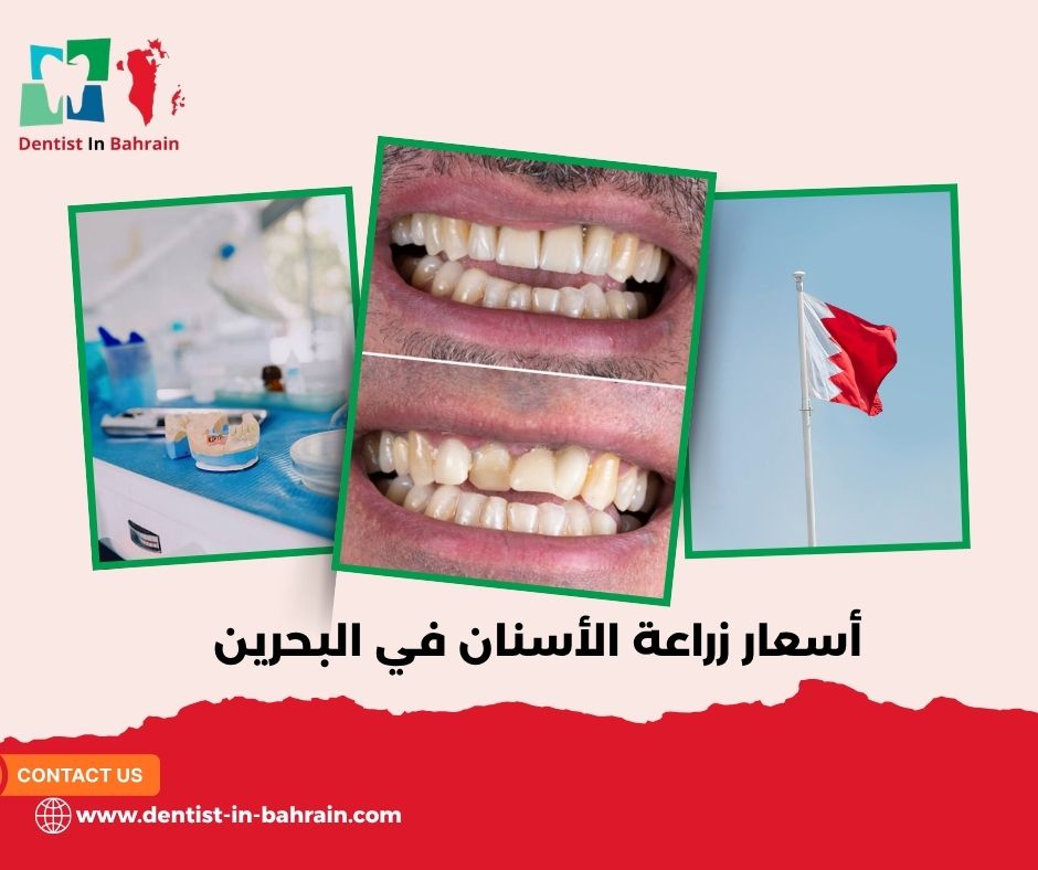 أسعار زراعة الأسنان في البحرين