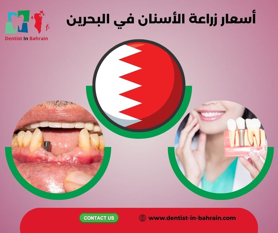 زراعة الاسنان في البحرين