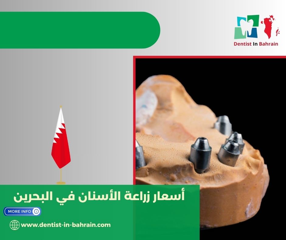 هي العوامل التي تحدد أسعار زراعة الأسنان في البحرين؟