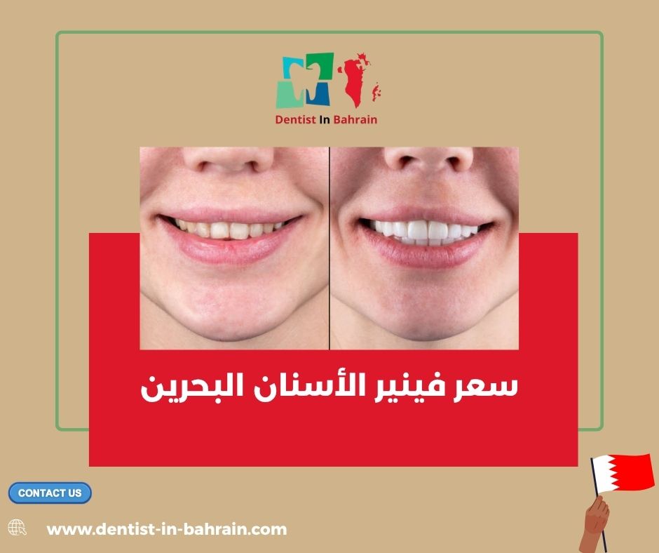 سعر فينير الأسنان البحرين