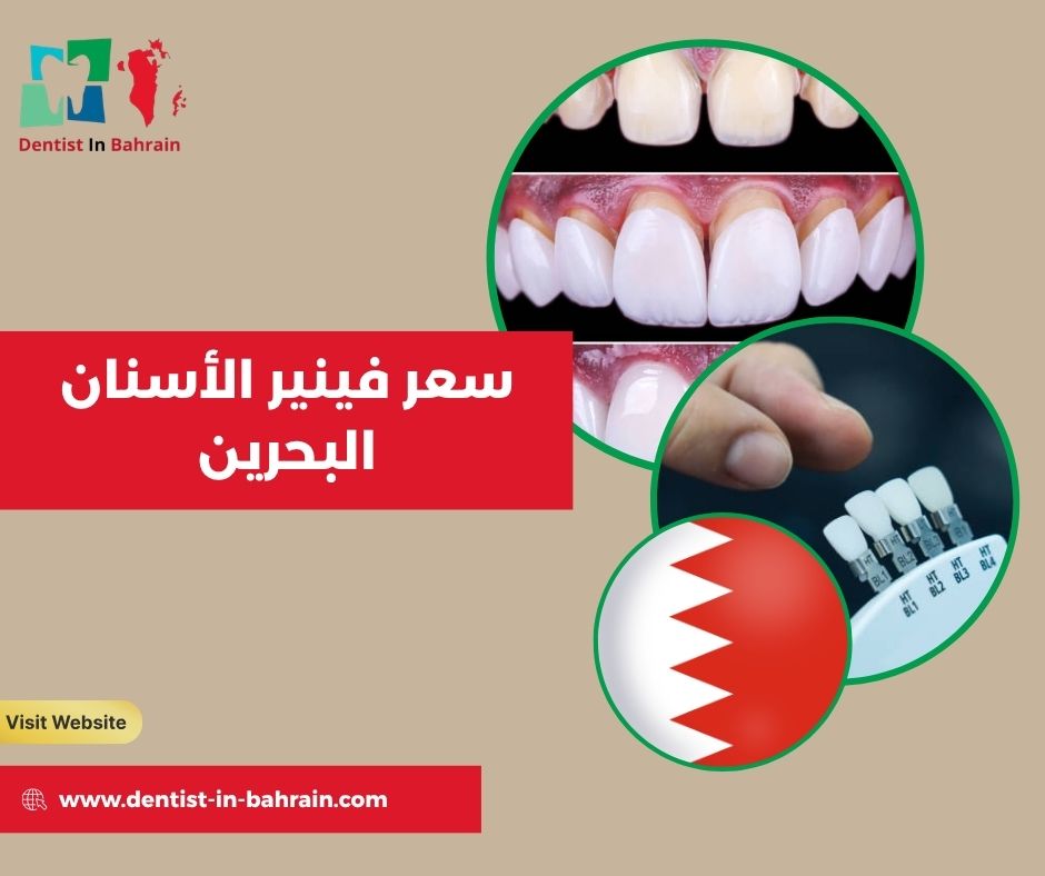 سعر الفينير في البحرين