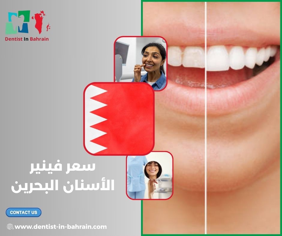سعر فينير الأسنان البحرين