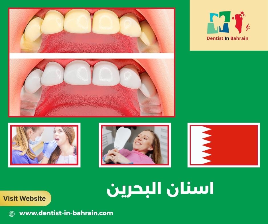 اسنان البحرين