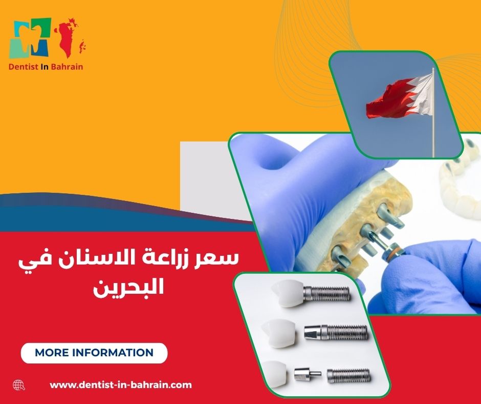 زراعة الأسنان في البحرين زراعة الأسنان في البحرين