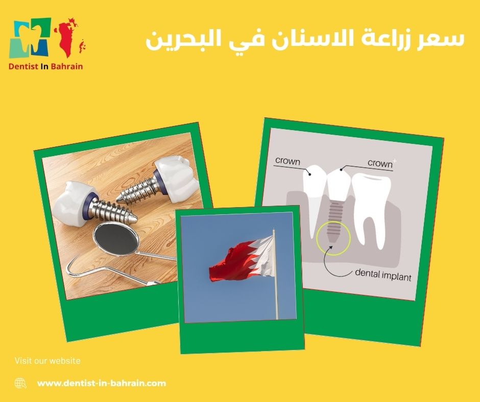 اسعار زراعة الاسنان في البحرين اسعار زراعة الاسنان في البحرين