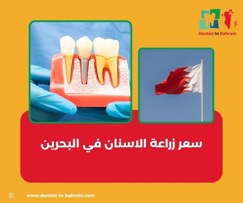 أسعار زراعة الأسنان في البحرين أسعار زراعة الأسنان في البحرين