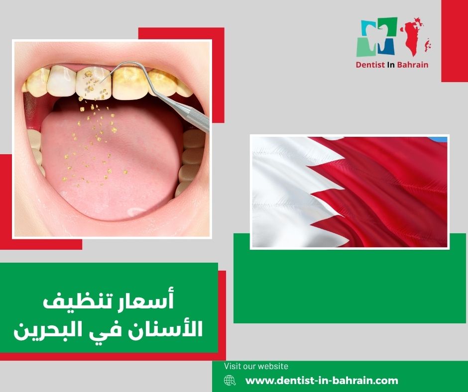 أسعار تنظيف الاسنان البحرين