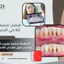 افضل اخصائي لثة في البحرين