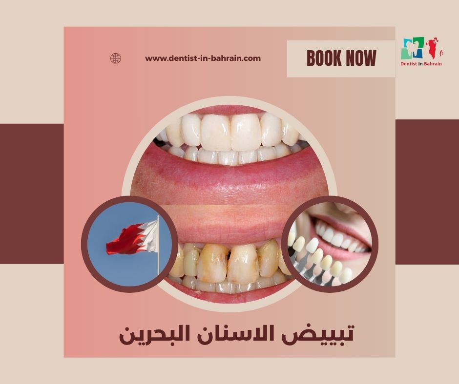تبييض الاسنان البحرين حسب المناطق