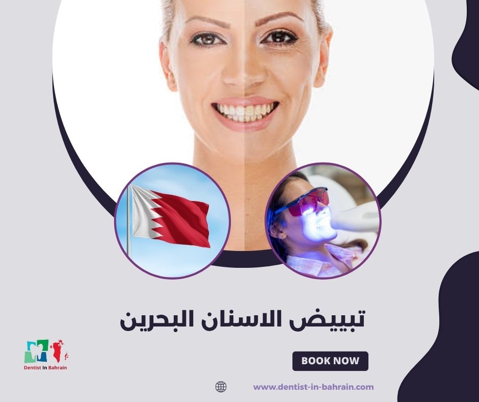 كم أسعار تبييض الأسنان في البحرين؟