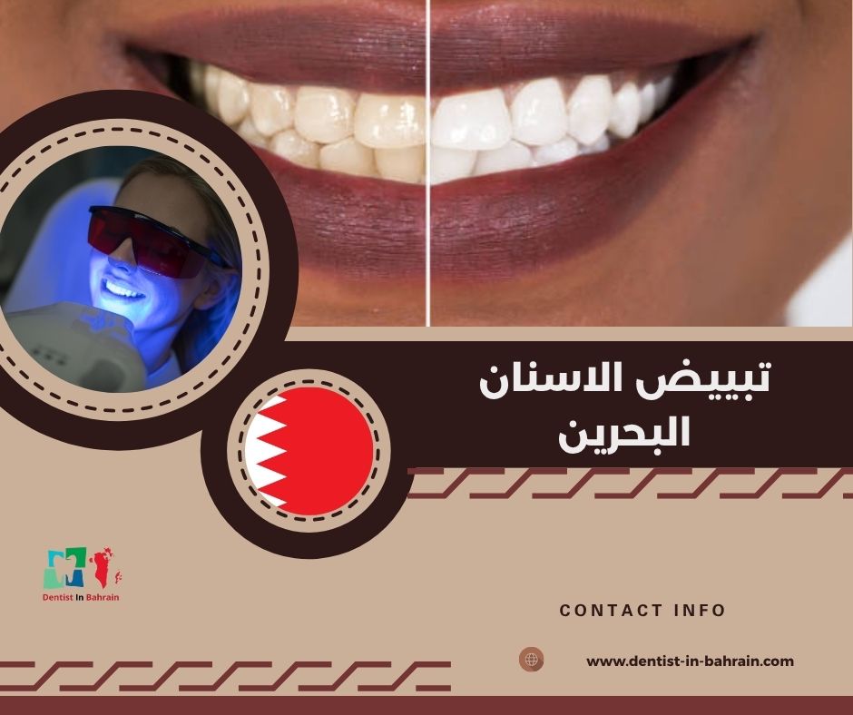 تبييض الاسنان البحرين