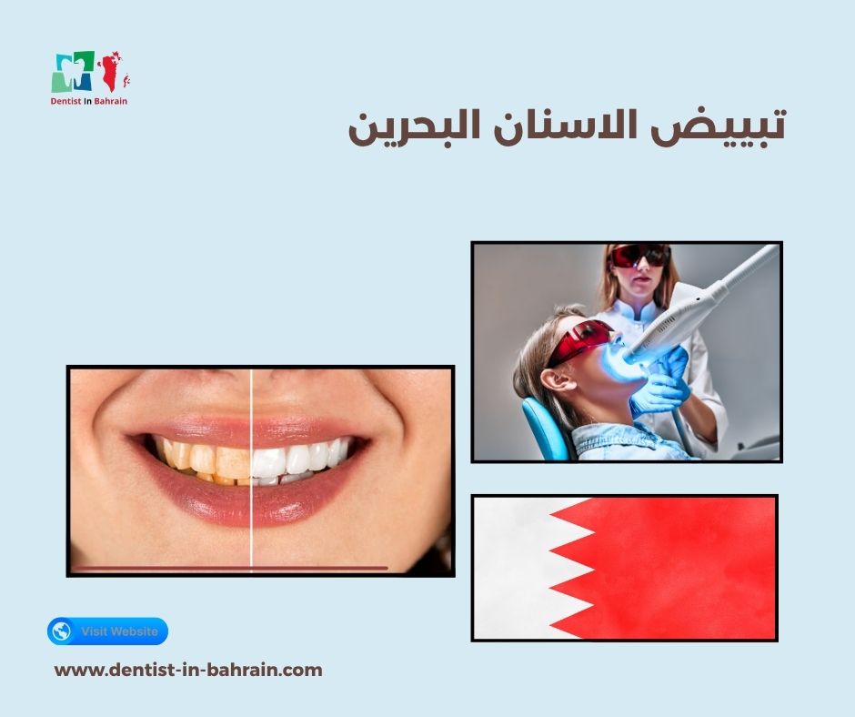 تبييض الاسنان البحرين