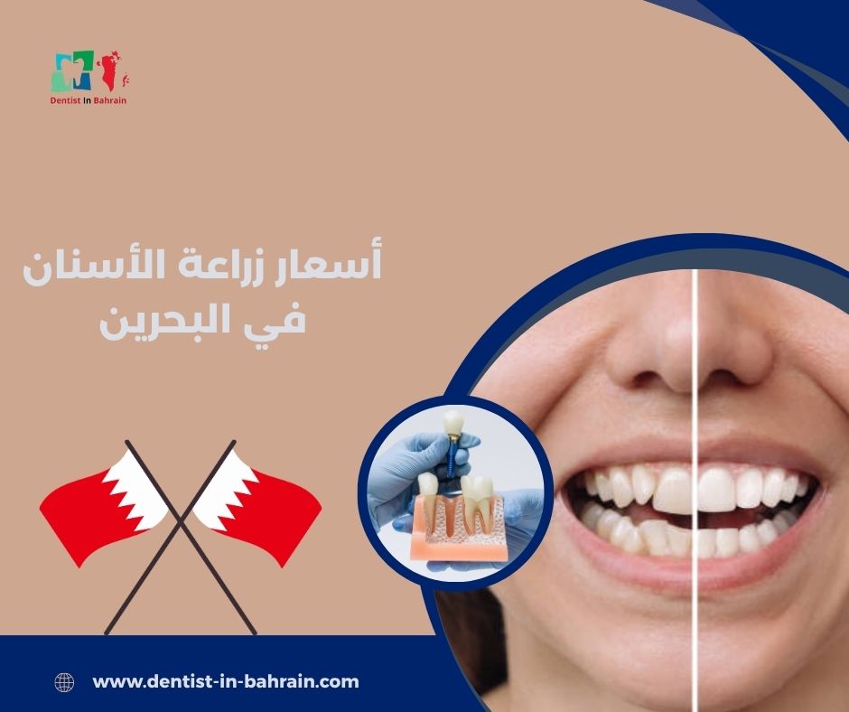 أسعار زراعة الأسنان في البحرين 