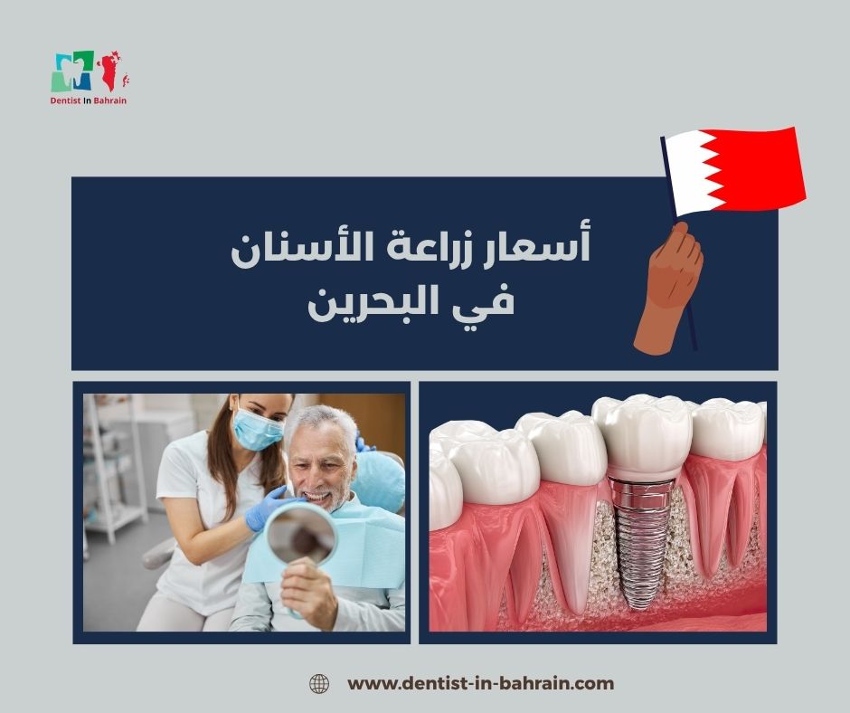 أسعار زراعة الأسنان في البحرين 