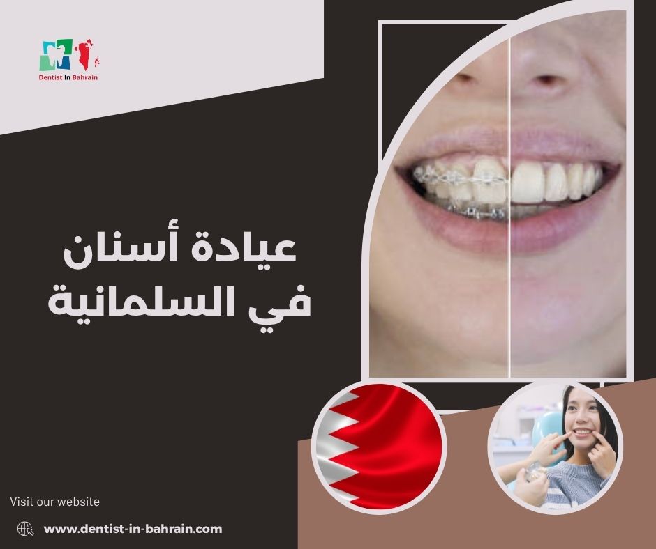 عيادة أسنان في السلمانية للتقويم والزراعة والتركيبات