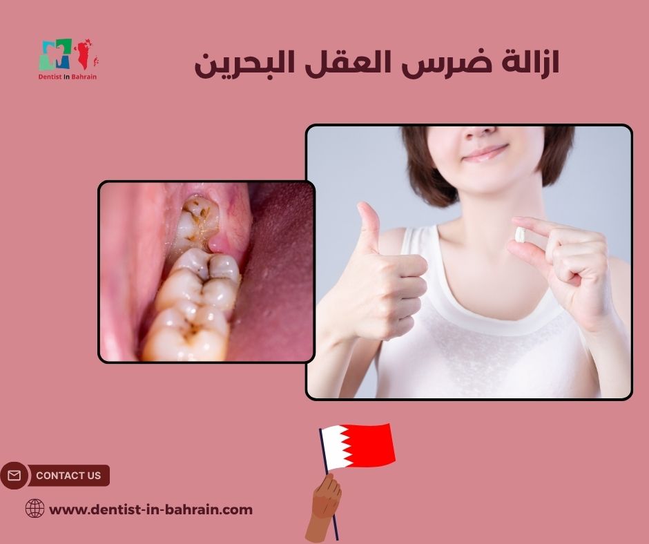 ازالة ضرس العقل البحرين