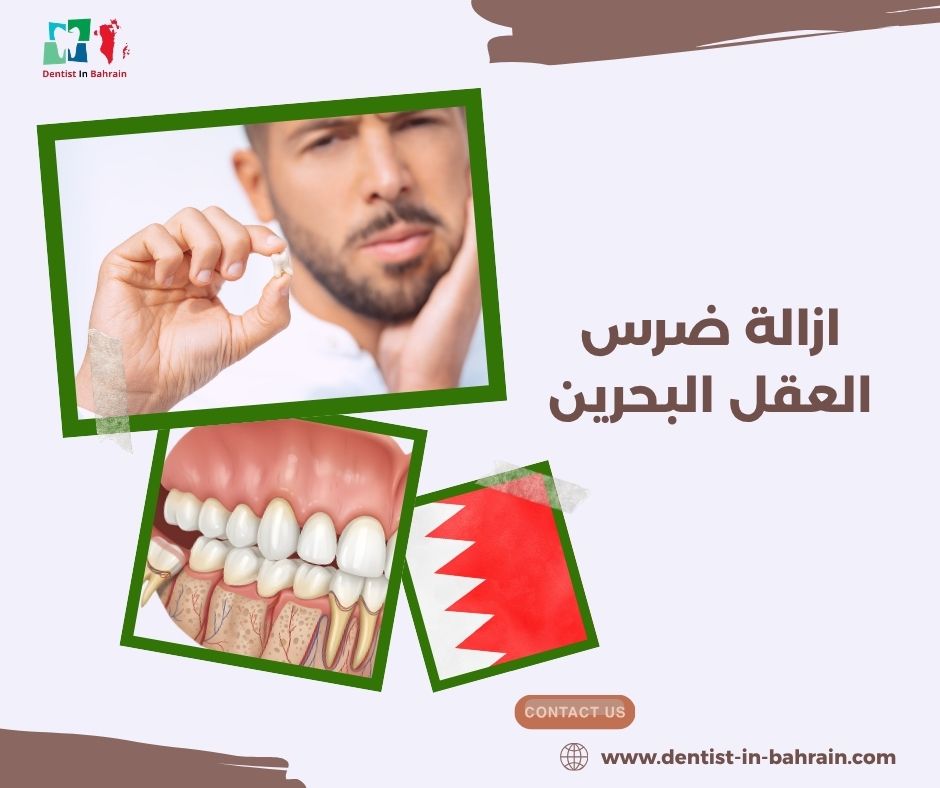 ازالة ضرس العقل البحرين