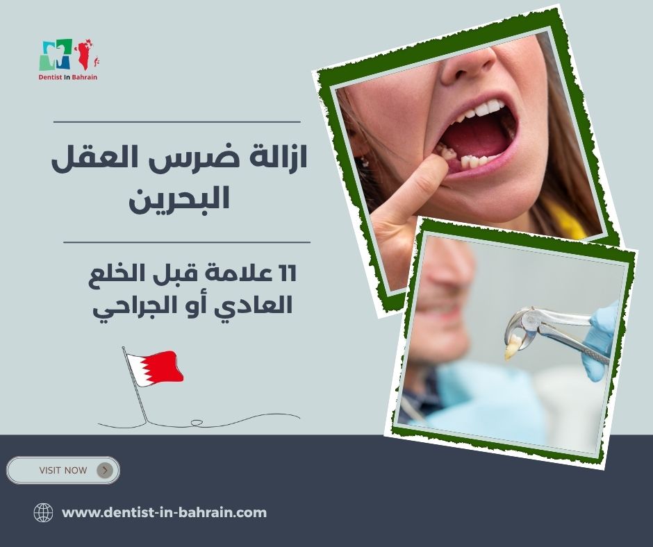 ازالة ضرس العقل البحرين