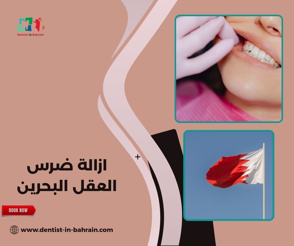 ازالة ضرس العقل البحرين