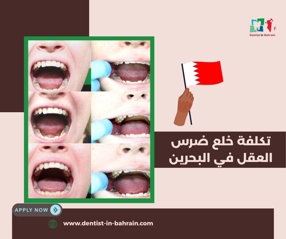 تكلفة خلع ضرس العقل في البحرين