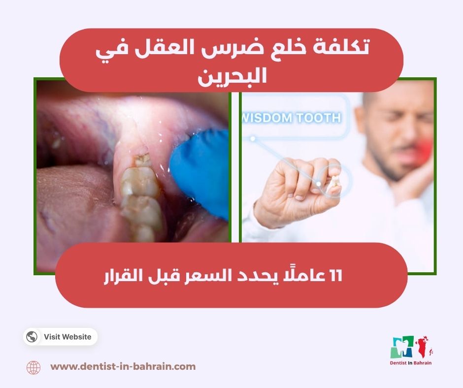 تكلفة خلع ضرس العقل في البحرين