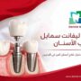 مركز أس بي أيسمايل لطب الأسنان
